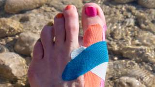 Kinesiotape bei Hallux Valgus anbringen