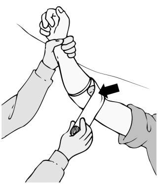 Illustration zeigt das Anlegen eines Verbandes an einem Unterarm, wobei eine Hand den Arm hält und mit der anderen Hand der Verband um den Unterarm gewickelt wird.